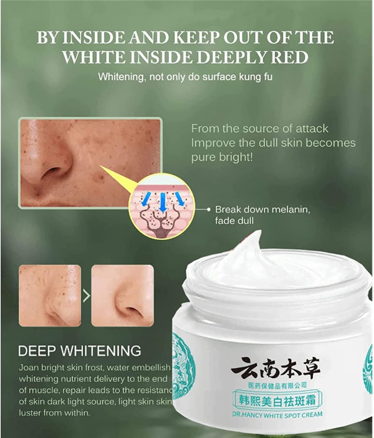 Japanese Melasma Cream Dr. Hancy White Spot Cream 20g