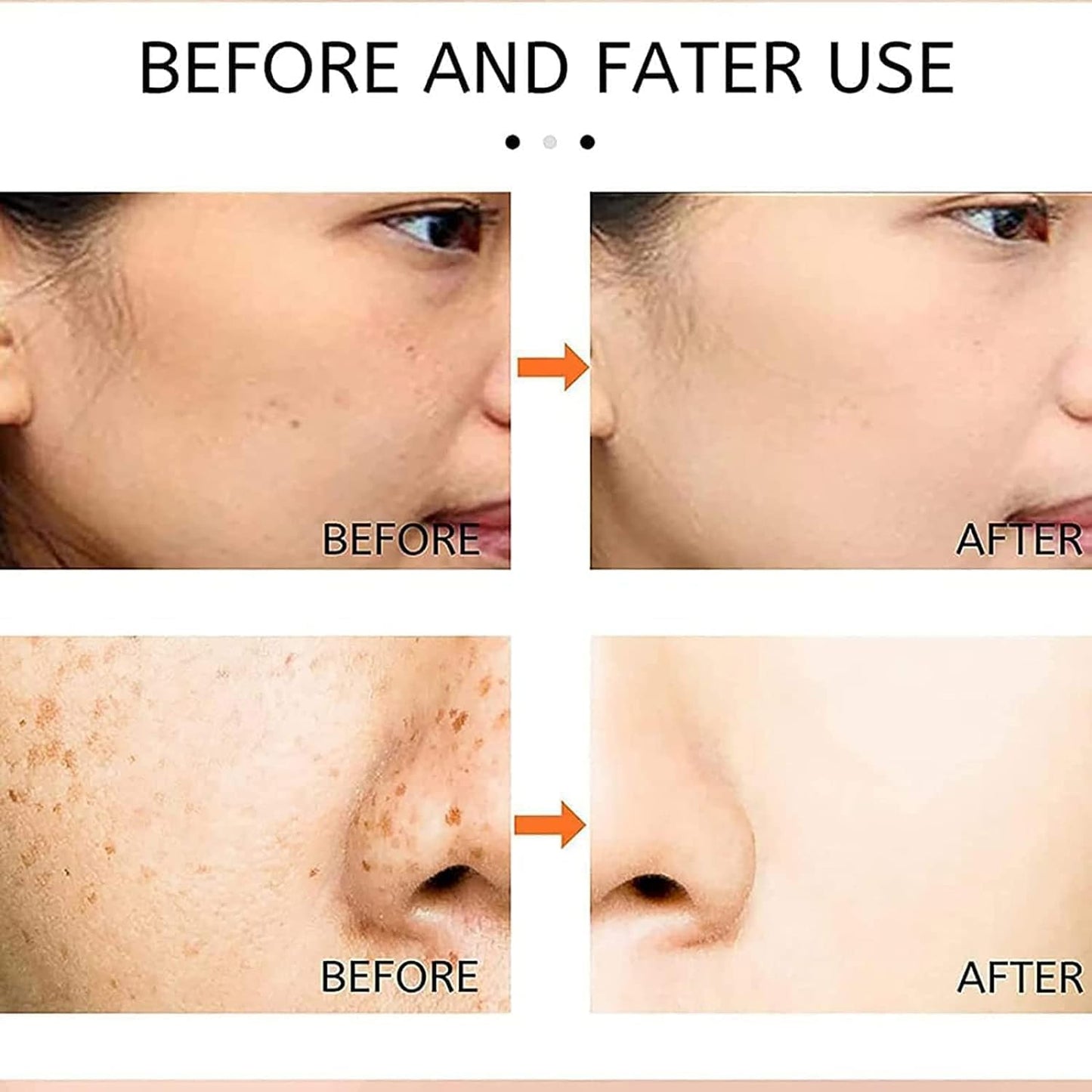 Japanese Melasma Cream Dr. Hancy White Spot Cream 20g