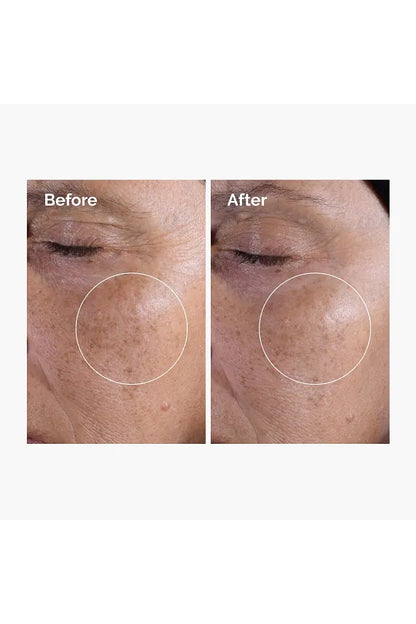 The Ordinary Glycolic Acid 7% Exfoliating Toner 240ml