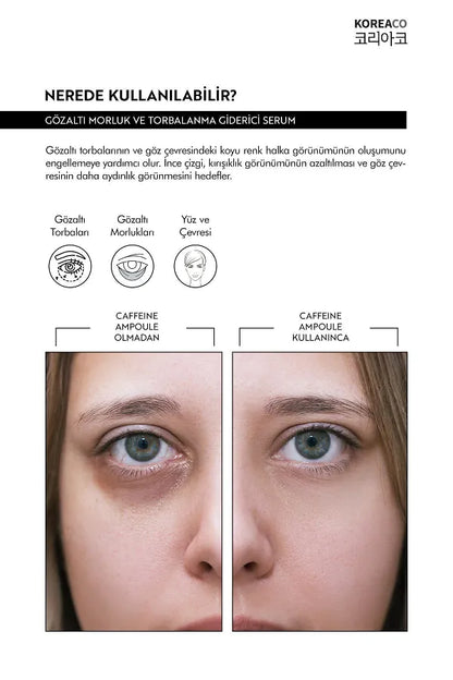 KOREACO Caffeine Ampoule Anti-Under Eye Bag & Dark Circle