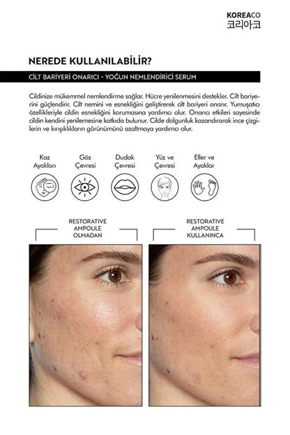 KOREACO Centella & Cica & Ceramide - Repairing, Brightening, 24 Hour Moisturizing Ampoule