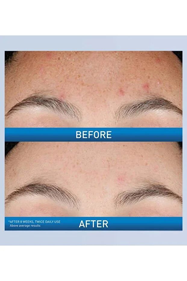 CeraVe Resurfacing Retinol Serum