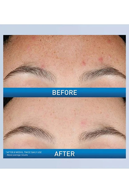 CeraVe Resurfacing Retinol Serum