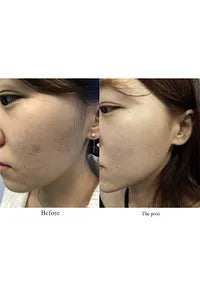 AXIS-Y 50ml Niacinamide Serum For Skin - Dark Spot Correcting, Anti Blemish, Brightening, Glow Serum