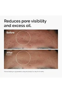 The Ordinary Niacinamide 10% Zinc 1% 30 ml
