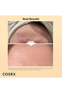 Cosrx 100ml Advanced Snail 96 Mucin Power Essence - Moisturizing And Nourishing Essence With Snail